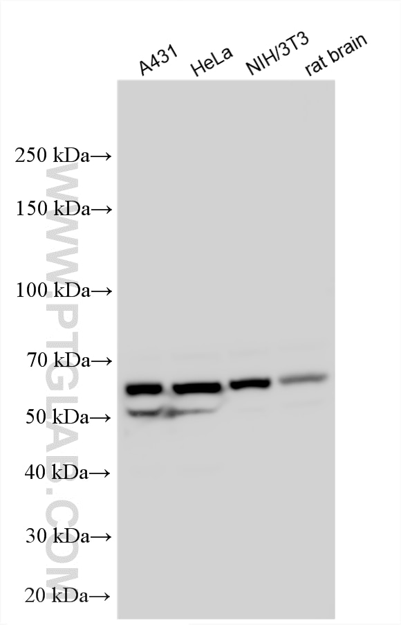Western Blot (WB) analysis of various lysates using HNRNPK Polyclonal antibody (11426-1-AP)