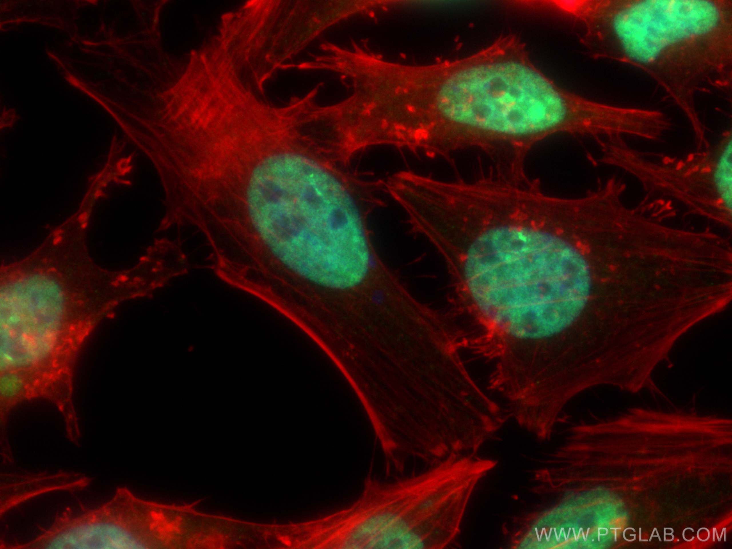 Immunofluorescence (IF) / fluorescent staining of HeLa cells using HNRNPL Polyclonal antibody (18354-1-AP)