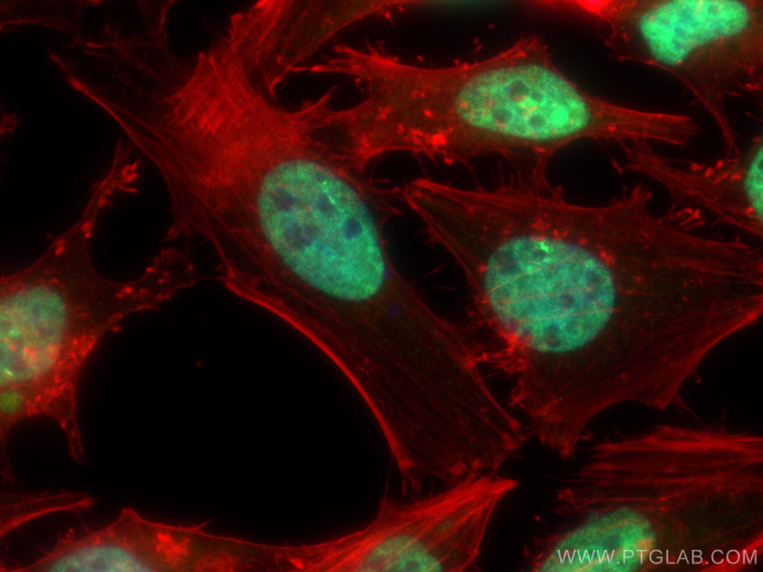 IF Staining of HeLa using 18354-1-AP