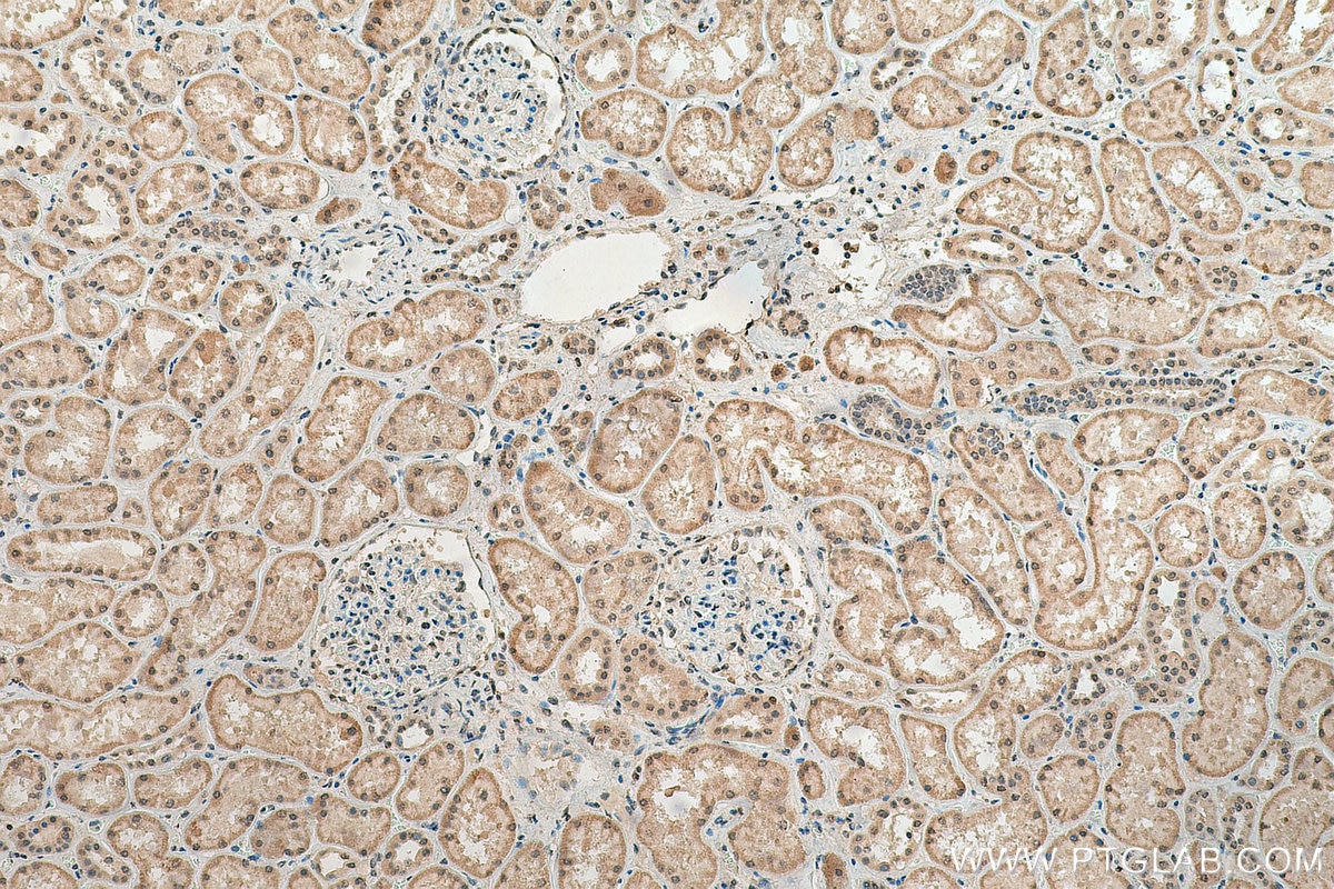 Immunohistochemistry (IHC) staining of human kidney tissue using HNRNPL Polyclonal antibody (18354-1-AP)