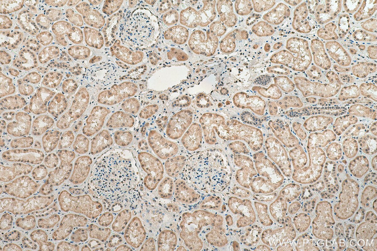 IHC staining of human kidney using 18354-1-AP