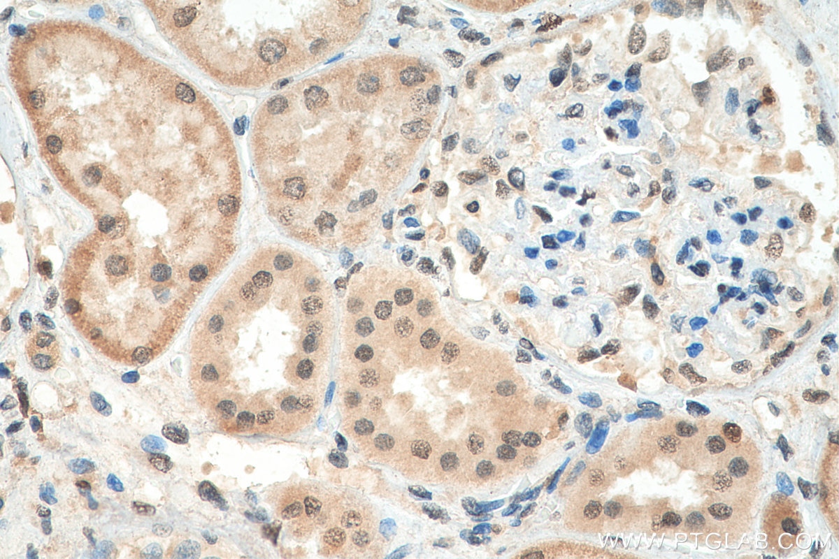 Immunohistochemistry (IHC) staining of human kidney tissue using HNRNPL Polyclonal antibody (18354-1-AP)