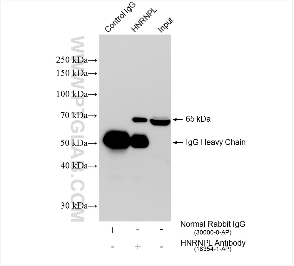 Immunoprecipitation (IP) experiment of BxPC-3 cells using HNRNPL Polyclonal antibody (18354-1-AP)
