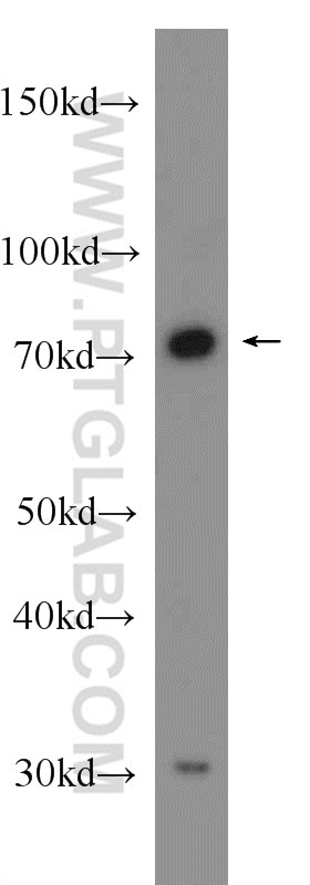 Western Blot (WB) analysis of mouse liver tissue using HNRNPL Polyclonal antibody (18354-1-AP)