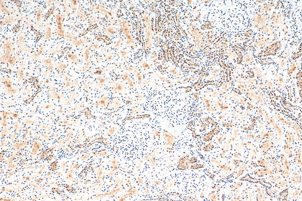 Immunohistochemistry (IHC) staining of human kidney tissue using HNRNPL Recombinant antibody (82259-1-RR)
