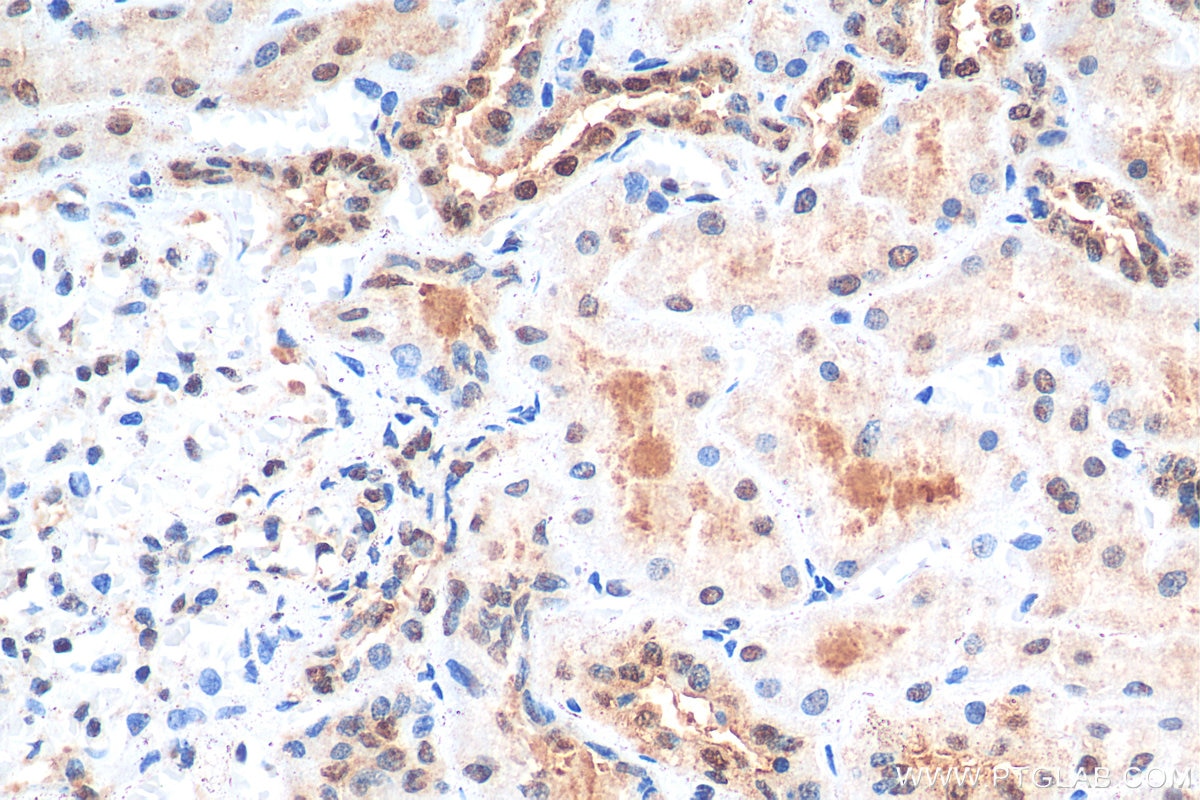 Immunohistochemistry (IHC) staining of human kidney tissue using HNRNPL Recombinant antibody (82259-1-RR)