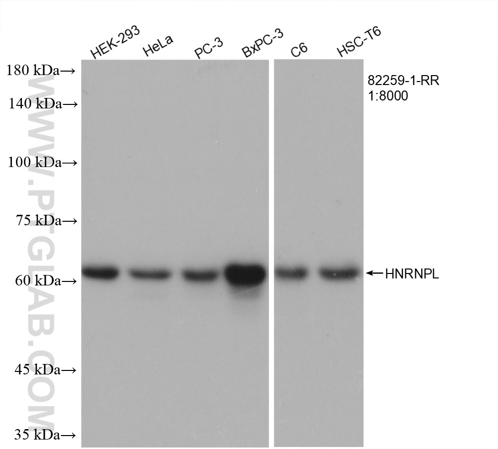 Western Blot (WB) analysis of various lysates using HNRNPL Recombinant antibody (82259-1-RR)