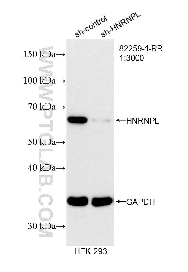 Western Blot (WB) analysis of HEK-293 cells using HNRNPL Recombinant monoclonal antibody (82259-1-RR)