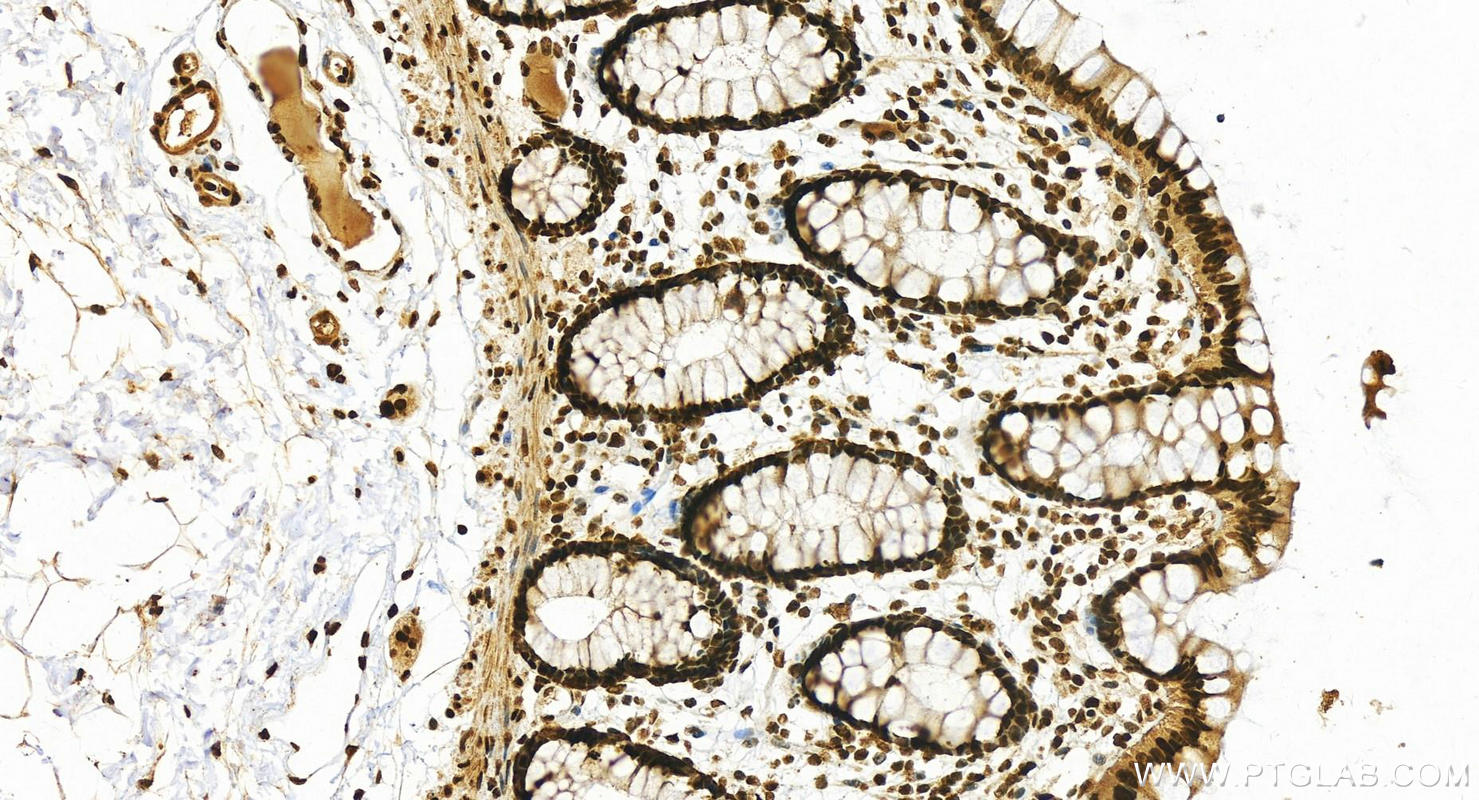 Immunohistochemistry (IHC) staining of human  colon using HNRNPM Polyclonal antibody (26897-1-AP)