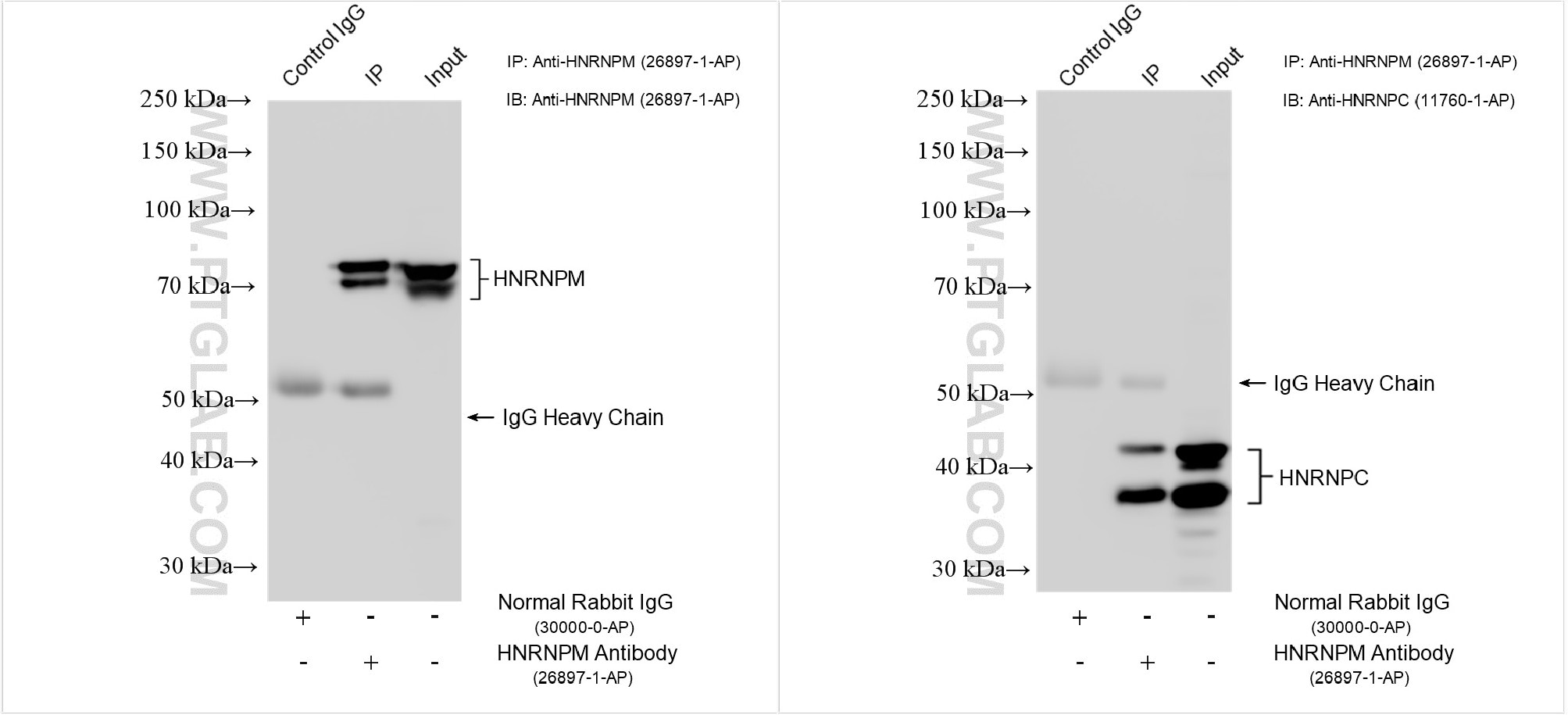 Immunoprecipitation (IP) experiment of HEK-293T cells using HNRNPM Polyclonal antibody (26897-1-AP)