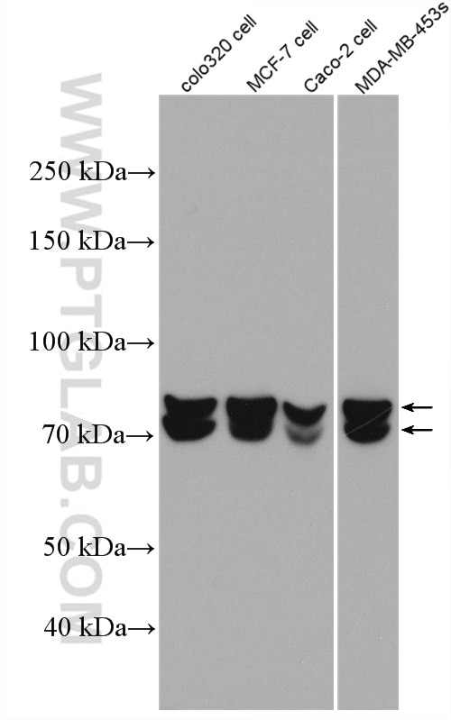 Western Blot (WB) analysis of COLO 320 cells using HNRNPM Polyclonal antibody (26897-1-AP)
