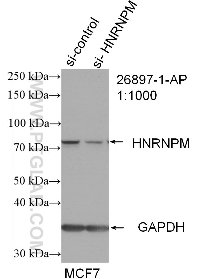 Western Blot (WB) analysis of MCF-7 cells using HNRNPM Polyclonal antibody (26897-1-AP)