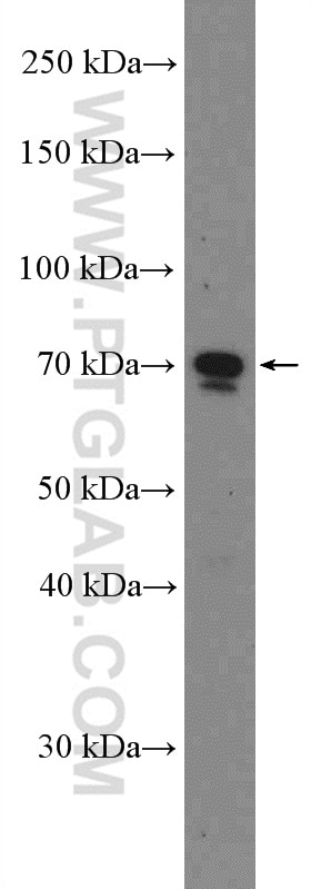 HNRNPM Polyclonal antibody