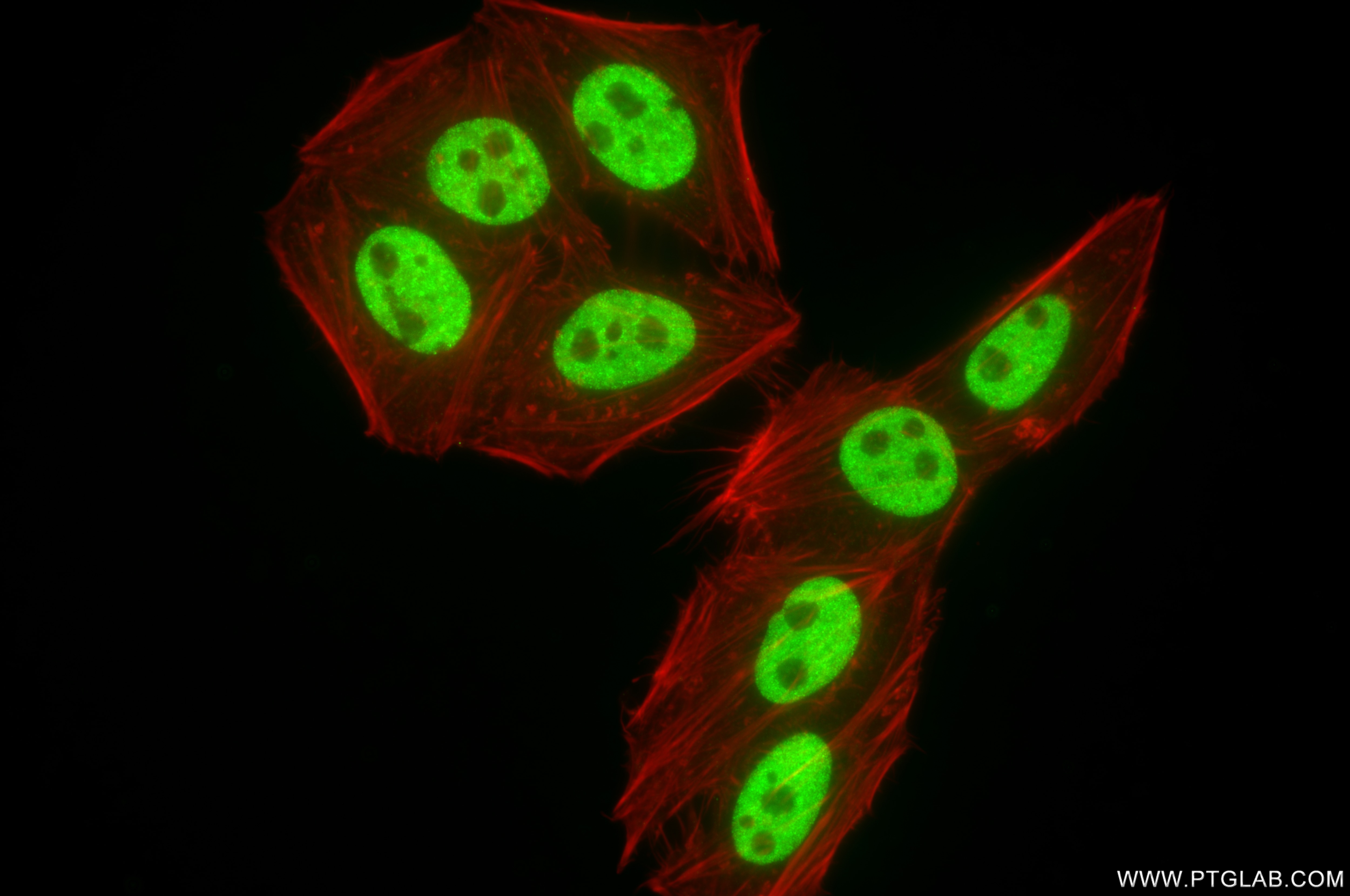 Immunofluorescence (IF) / fluorescent staining of HepG2 cells using HNRNPM Recombinant antibody (85422-1-RR)