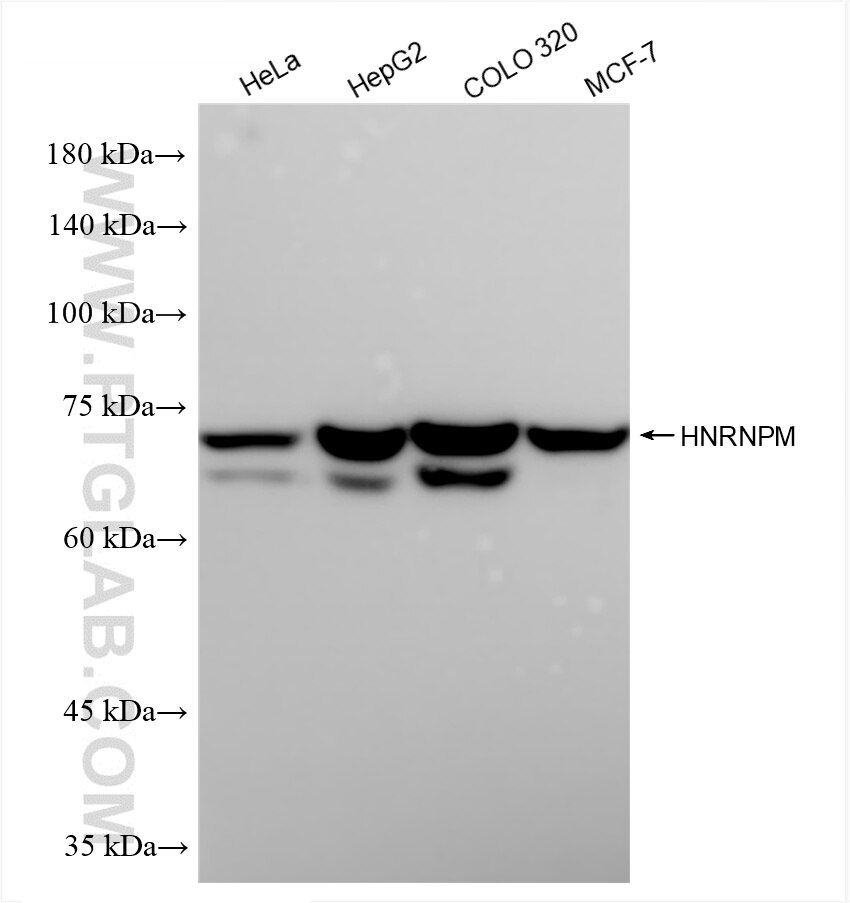 Western Blot (WB) analysis of various lysates using HNRNPM Recombinant antibody (85422-1-RR)