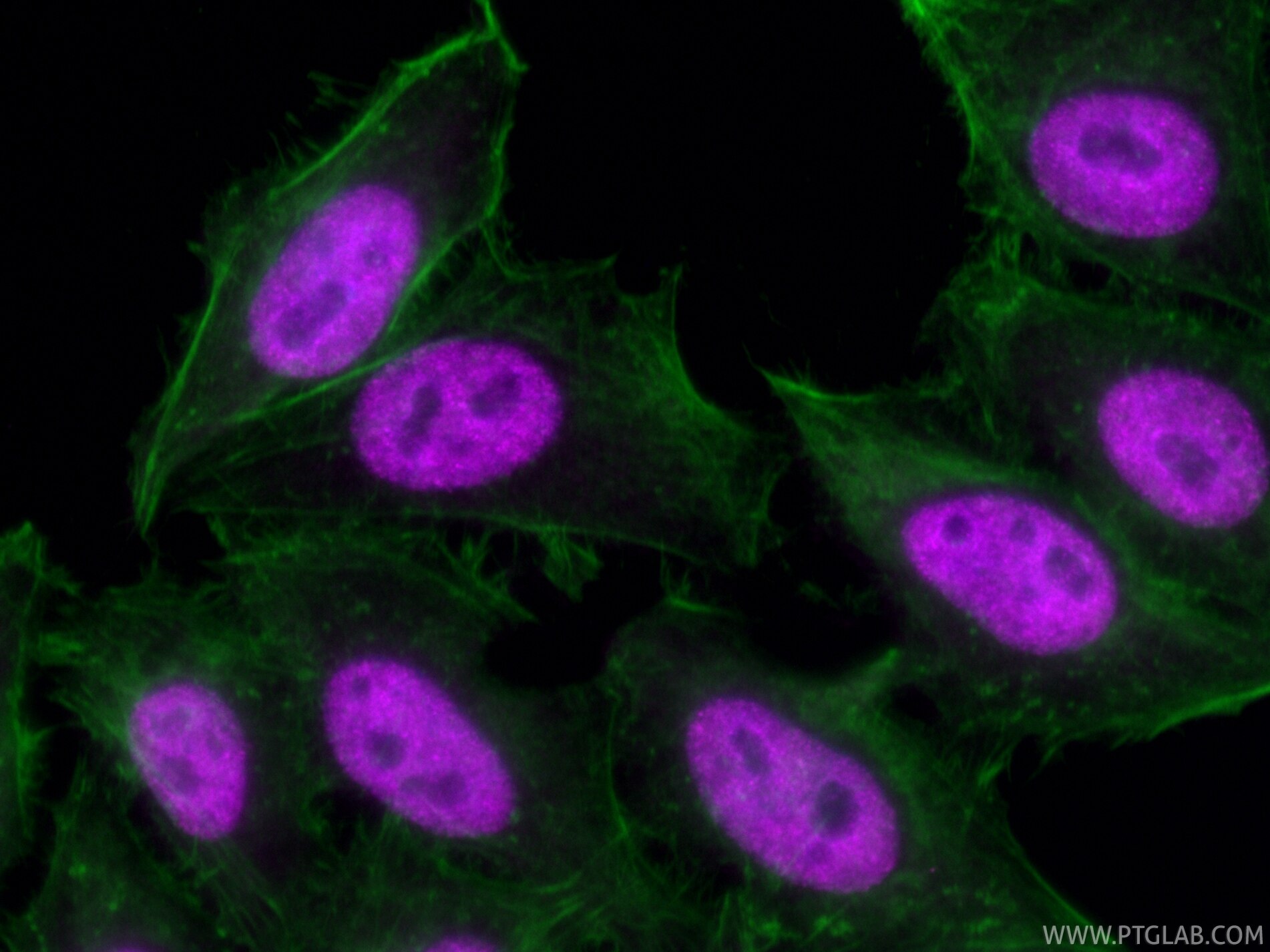 Immunofluorescence (IF) / fluorescent staining of HepG2 cells using CoraLite® Plus 647-conjugated HNRNPM Recombinant m (CL647-85422)