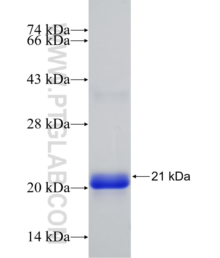 HNRNPM fusion protein Ag25474 SDS-PAGE