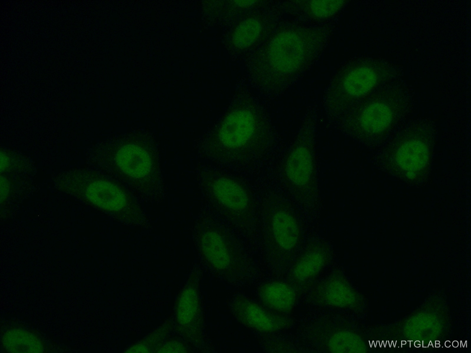 Immunofluorescence (IF) / fluorescent staining of HepG2 cells using HNRNPR Polyclonal antibody (15018-1-AP)