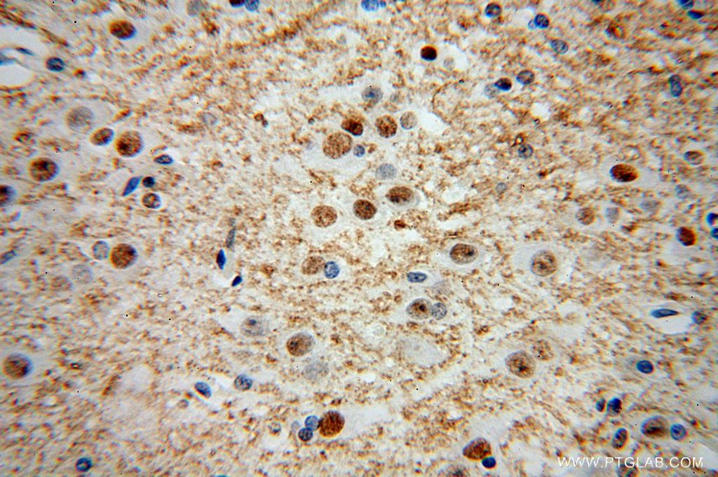 Immunohistochemistry (IHC) staining of human brain tissue using HNRNPR Polyclonal antibody (15018-1-AP)