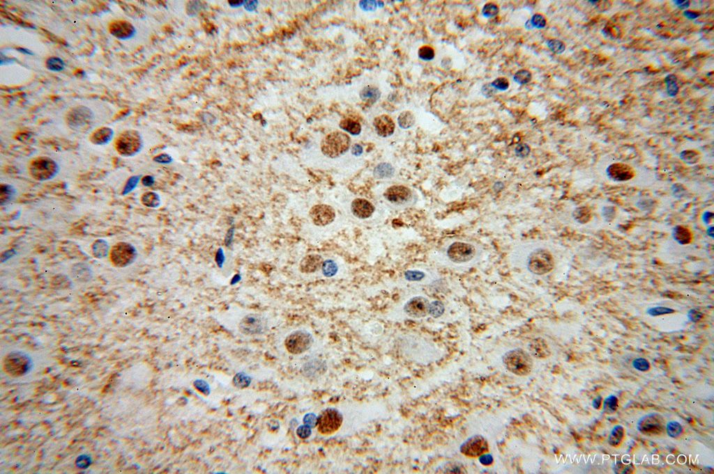 Immunohistochemistry (IHC) staining of human brain tissue using HNRNPR Polyclonal antibody (15018-1-AP)