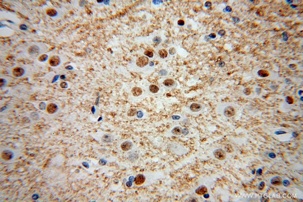 IHC staining of human brain using 15018-1-AP