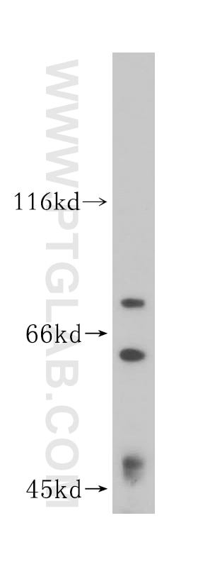 Western Blot (WB) analysis of HepG2 cells using HNRNPR Polyclonal antibody (15018-1-AP)