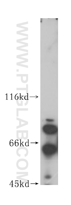 Western Blot (WB) analysis of HeLa cells using HNRNPR Polyclonal antibody (15018-1-AP)