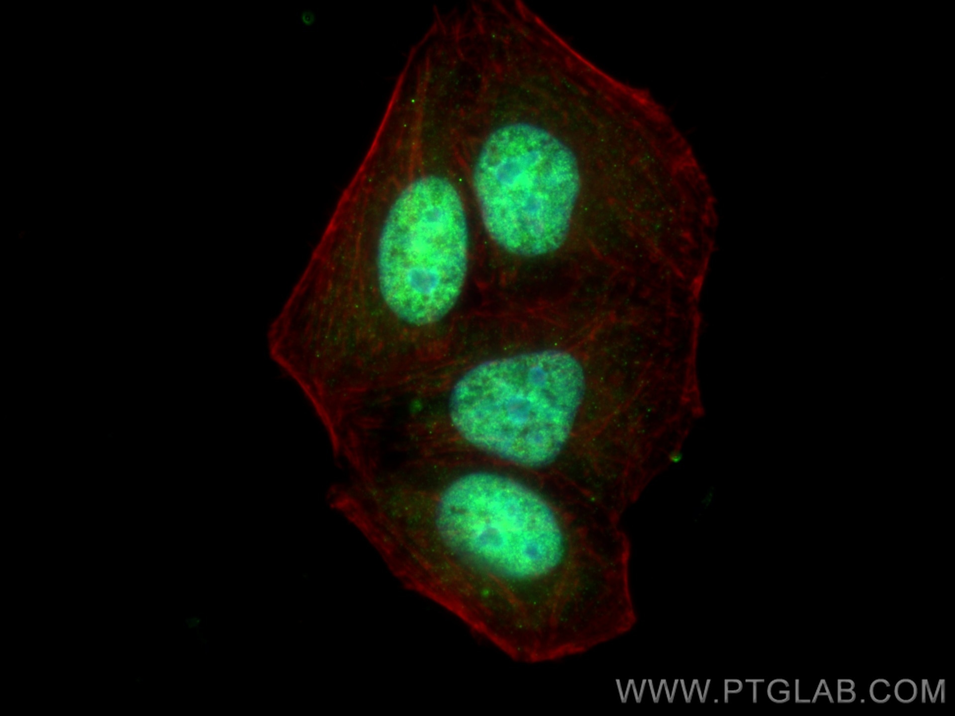 Immunofluorescence (IF) / fluorescent staining of HepG2 cells using HNRNPR Polyclonal antibody (29980-1-AP)