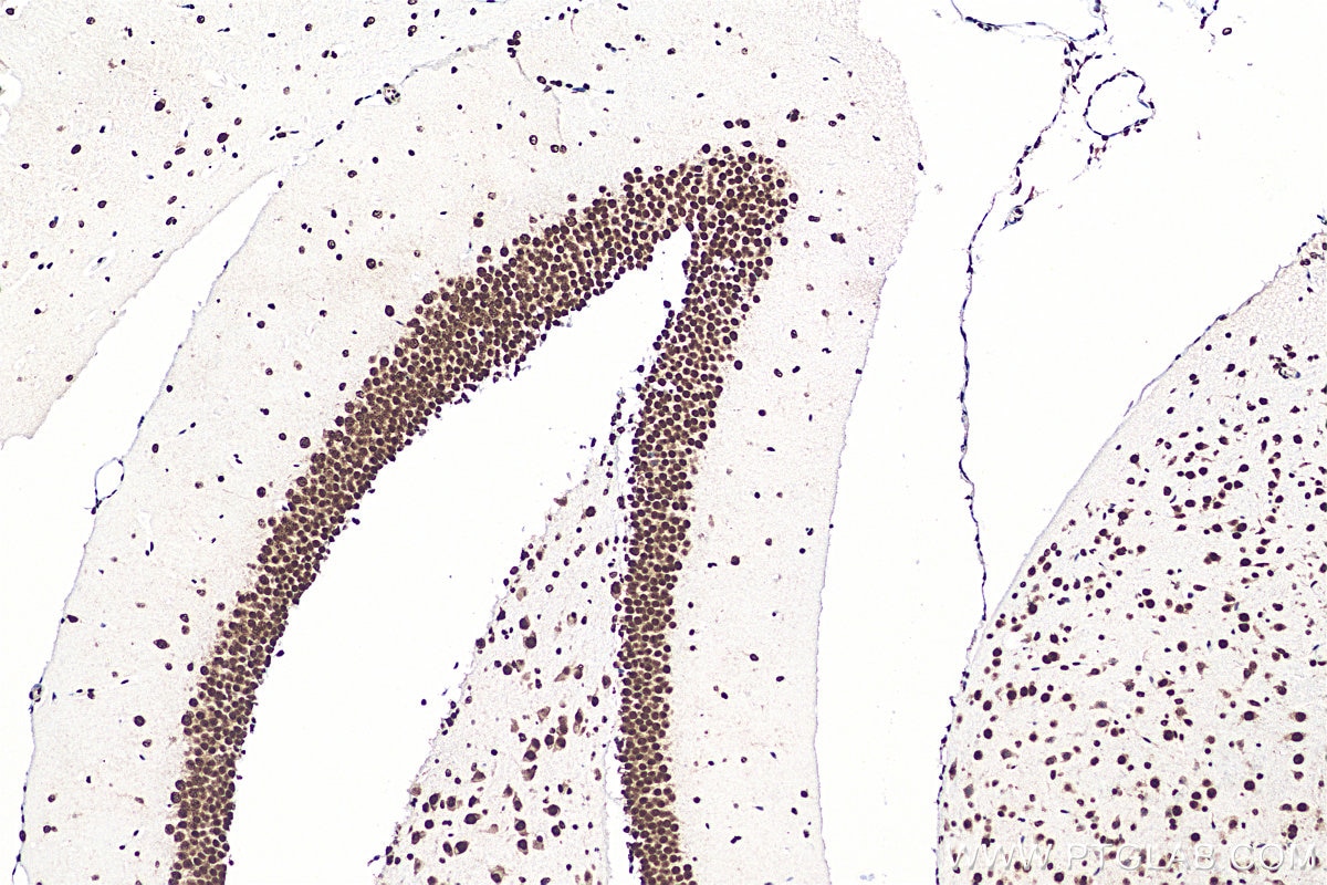 Immunohistochemistry (IHC) staining of mouse brain tissue using HNRNPR Polyclonal antibody (29980-1-AP)