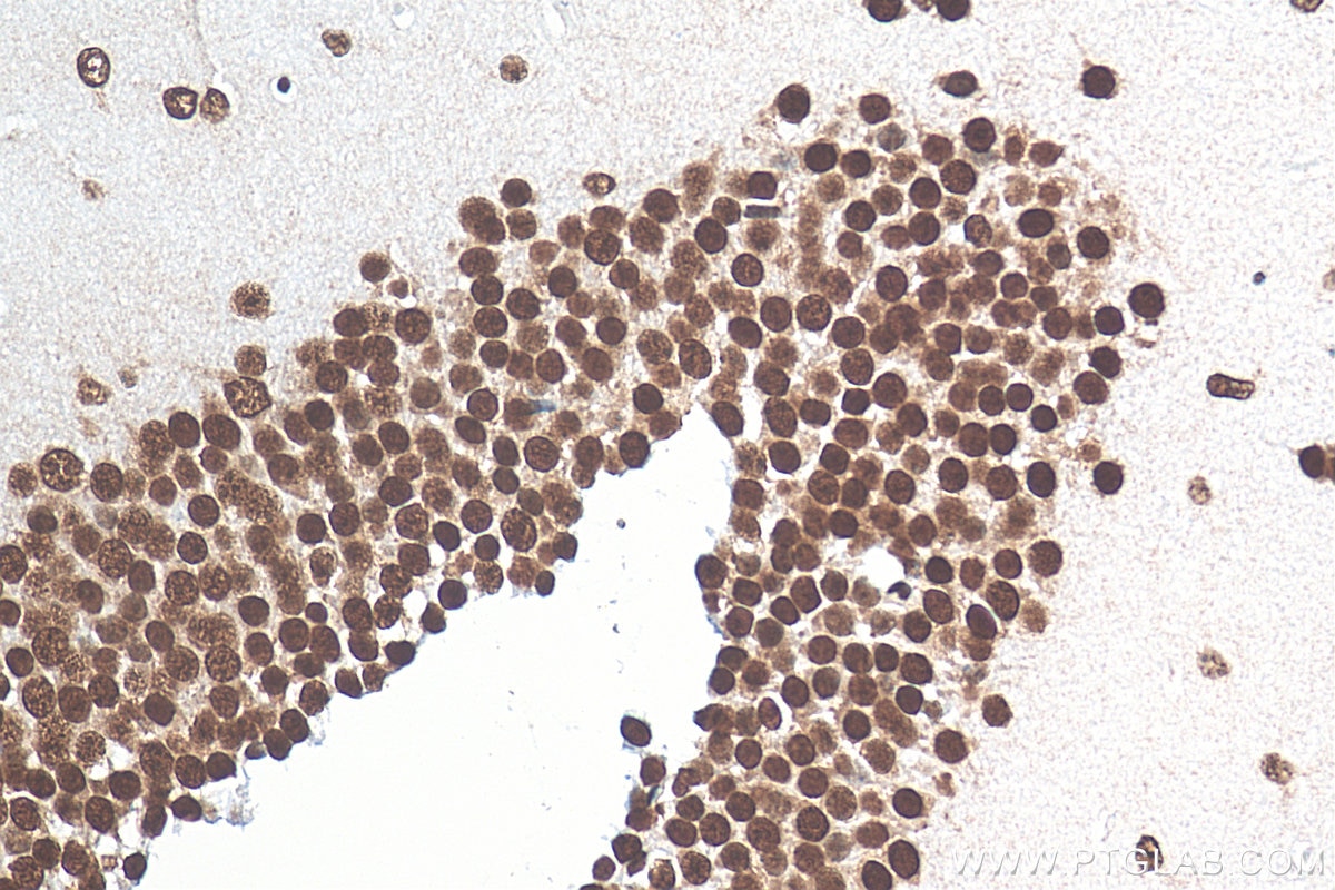 Immunohistochemistry (IHC) staining of mouse brain tissue using HNRNPR Polyclonal antibody (29980-1-AP)