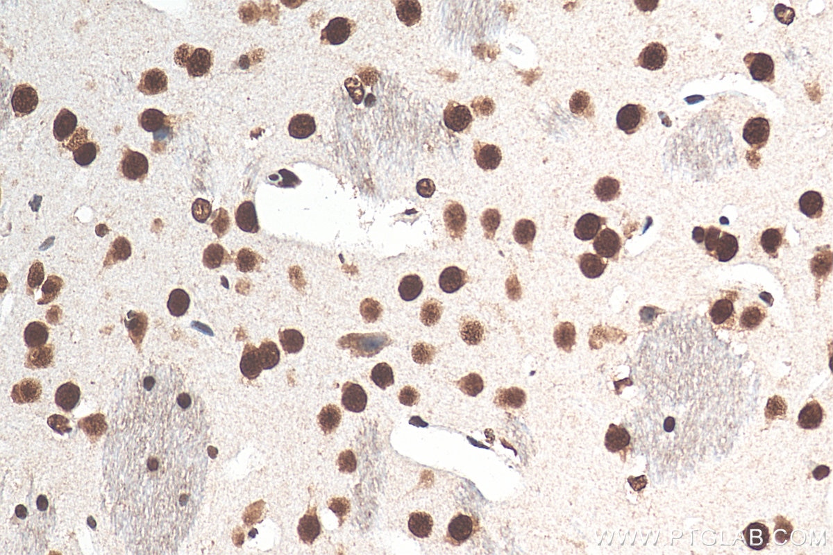 Immunohistochemistry (IHC) staining of mouse brain tissue using HNRNPR Polyclonal antibody (29980-1-AP)