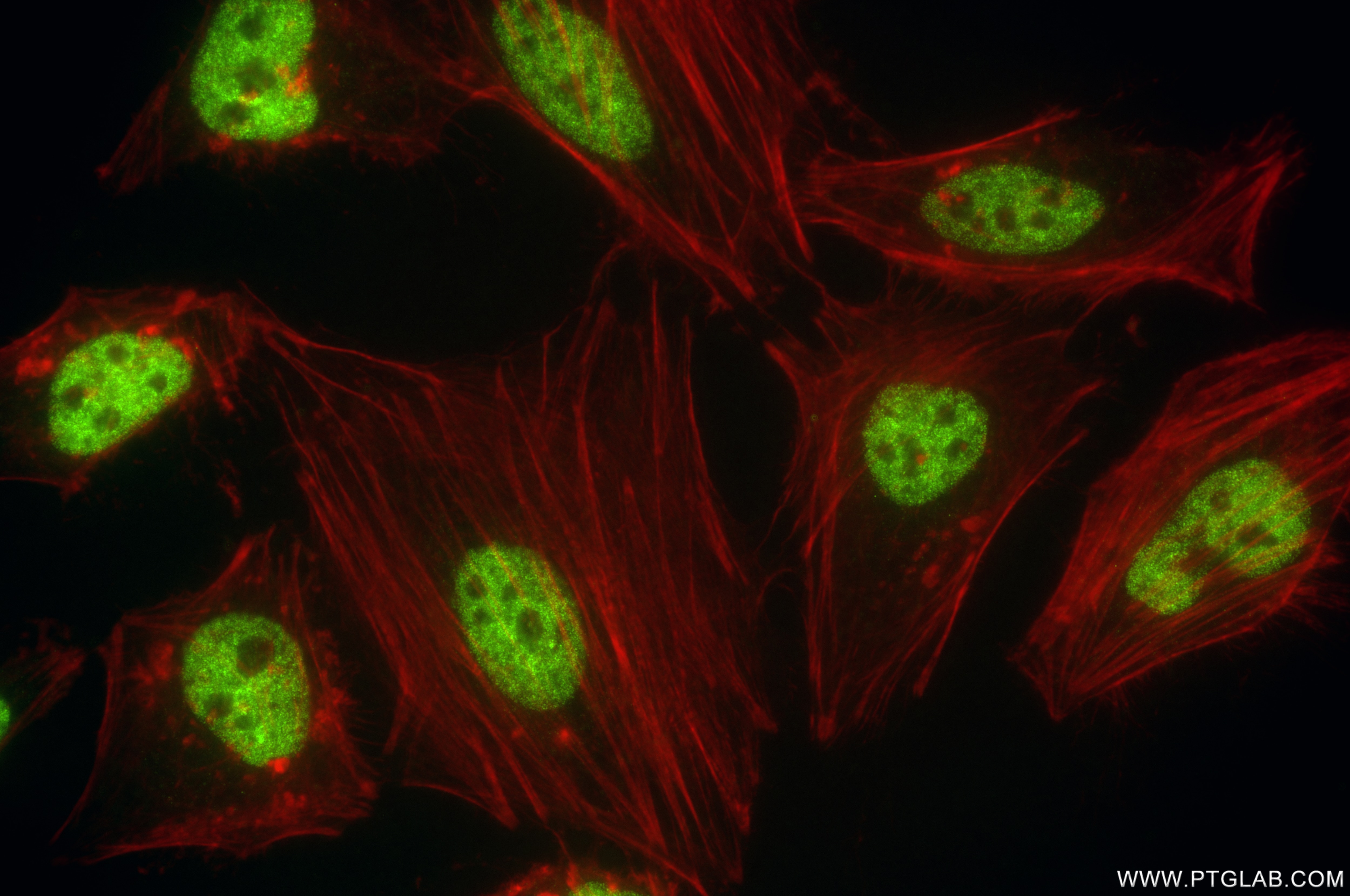 Immunofluorescence (IF) / fluorescent staining of HeLa cells using HNRNPR Recombinant antibody (85078-5-RR)