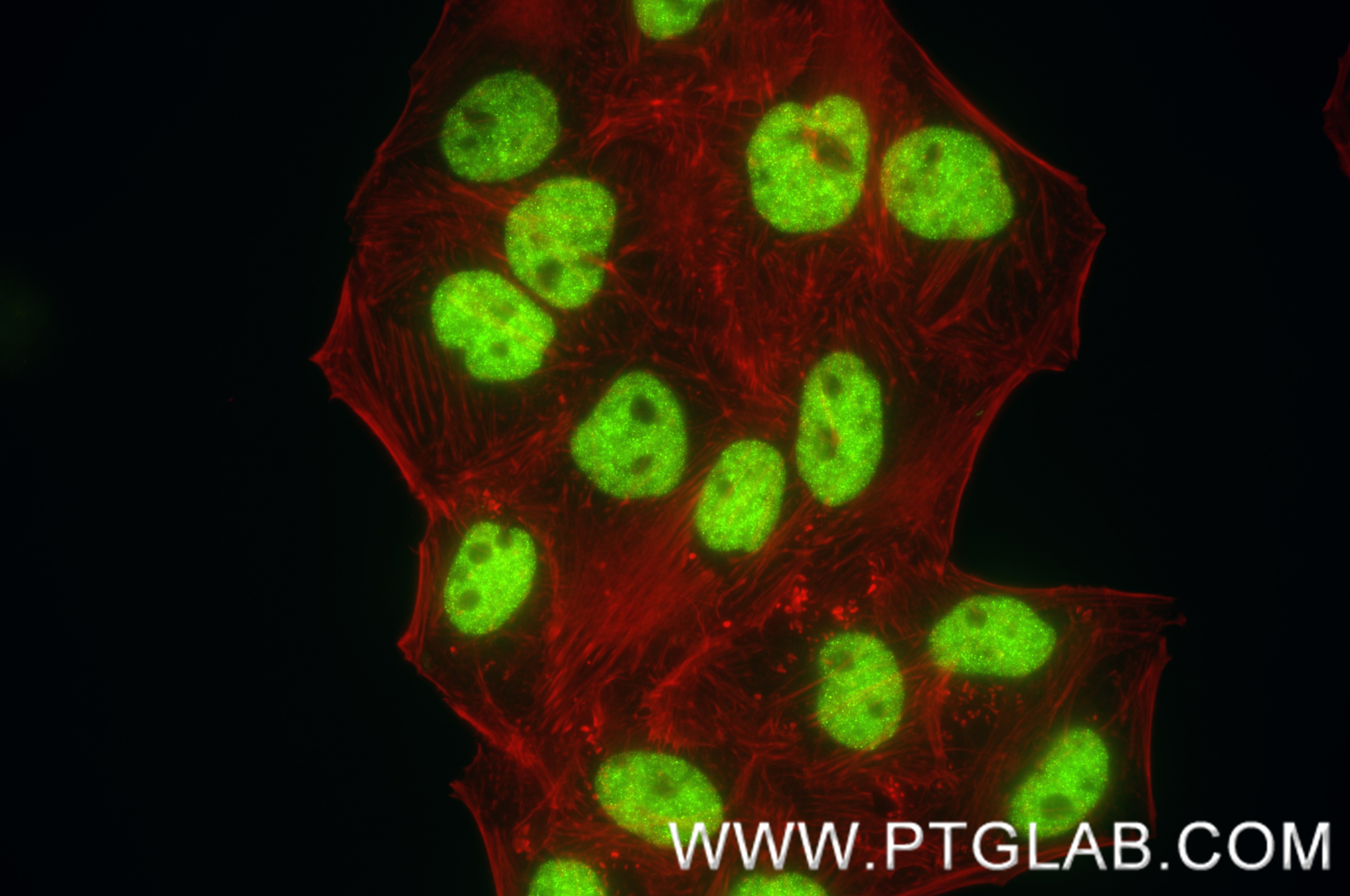 Immunofluorescence (IF) / fluorescent staining of HepG2 cells using HNRNPR Recombinant antibody (85078-5-RR)
