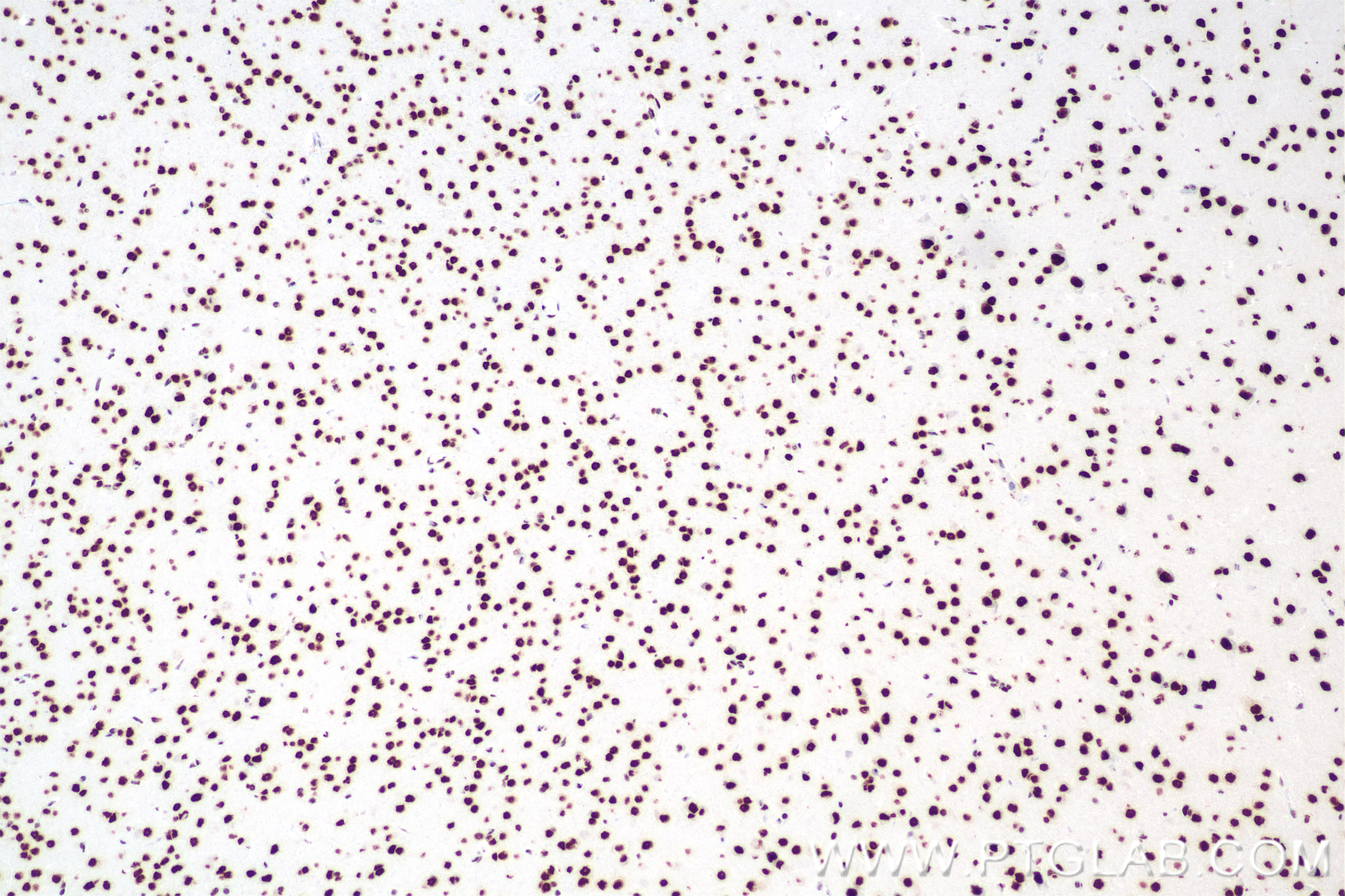 Immunohistochemistry (IHC) staining of mouse brain tissue using HNRNPR Recombinant antibody (85078-5-RR)