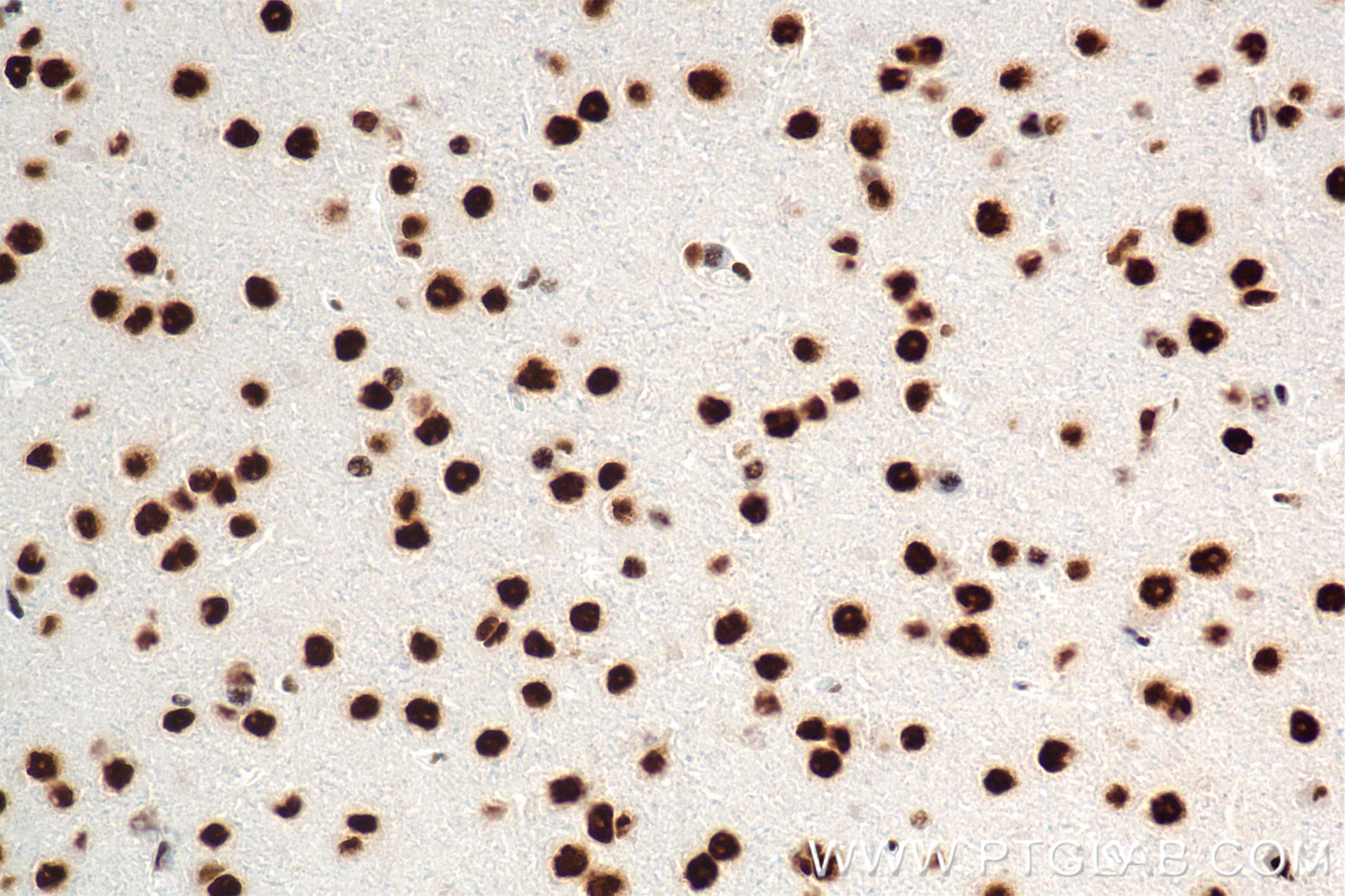 Immunohistochemistry (IHC) staining of mouse brain tissue using HNRNPR Recombinant antibody (85078-5-RR)
