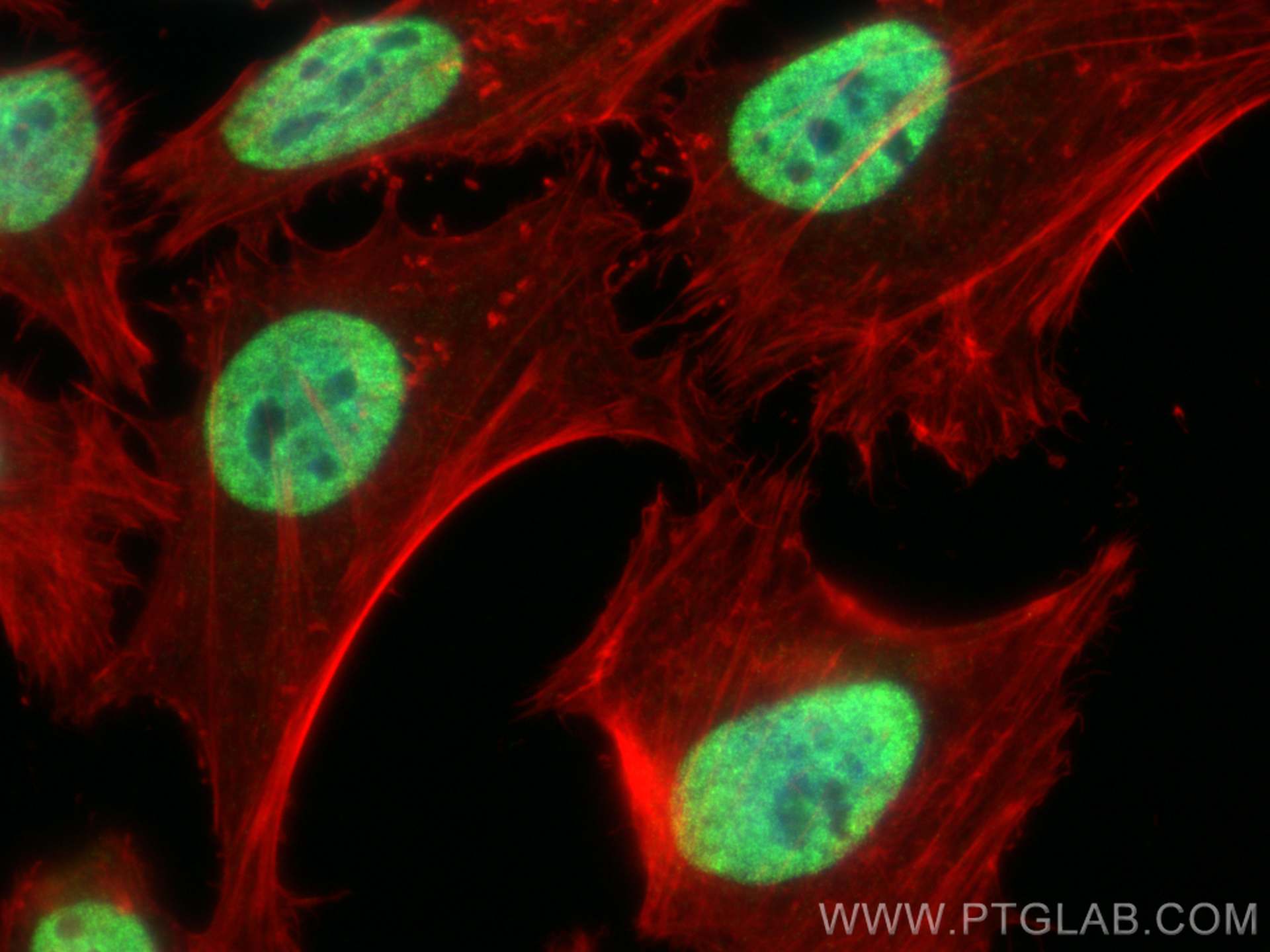 Immunofluorescence (IF) / fluorescent staining of HeLa cells using HNRNPU Polyclonal antibody (14599-1-AP)