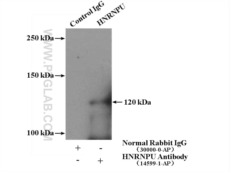 Immunoprecipitation (IP) experiment of HeLa cells using HNRNPU Polyclonal antibody (14599-1-AP)