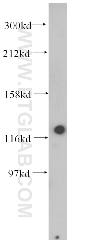 Western Blot (WB) analysis of mouse lung tissue using HNRNPU Polyclonal antibody (14599-1-AP)
