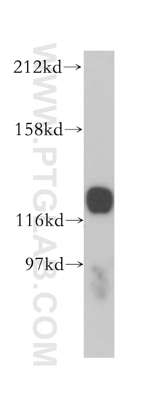 HNRNPU Polyclonal antibody