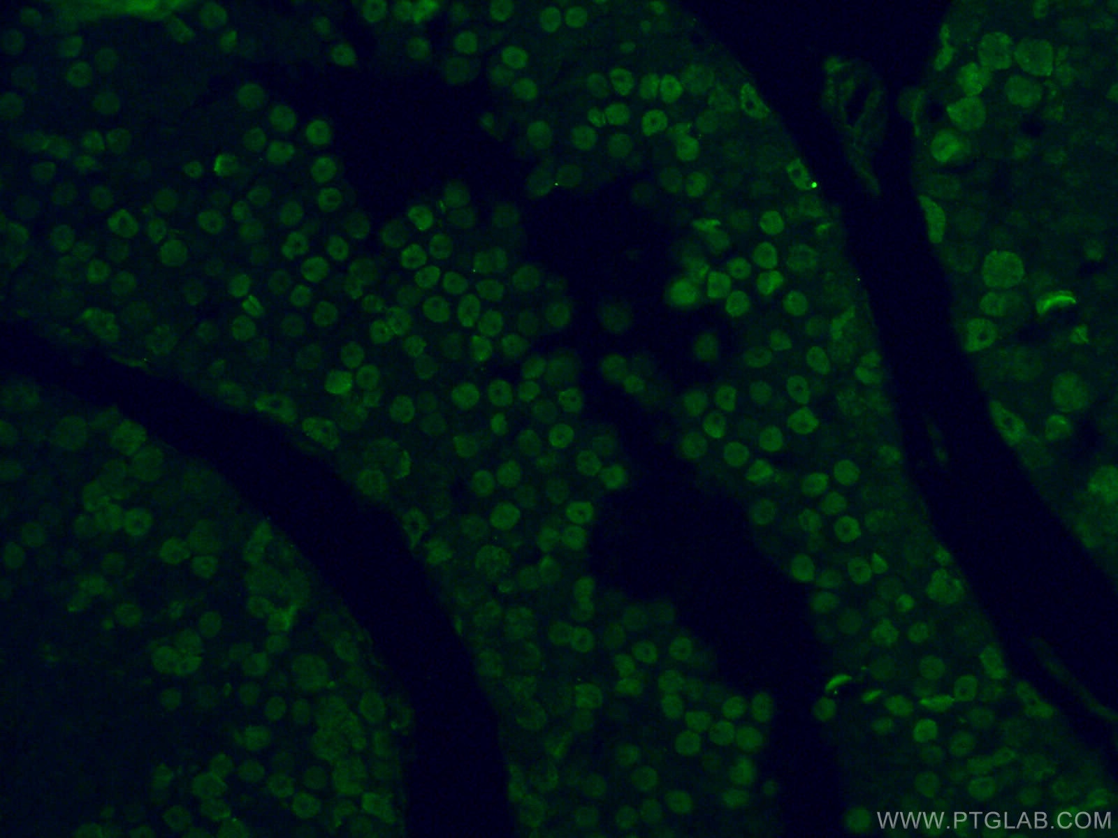 Immunofluorescence (IF) / fluorescent staining of mouse testis tissue using HNRNPU Polyclonal antibody (16365-1-AP)