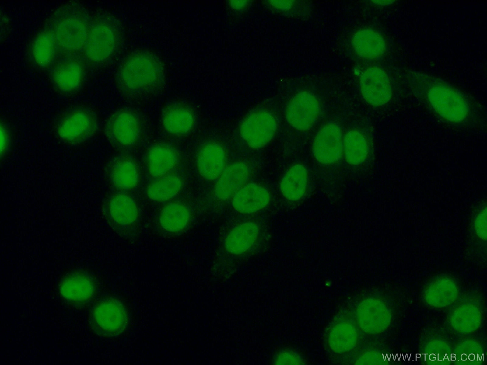 Immunofluorescence (IF) / fluorescent staining of HeLa cells using HNRNPU Polyclonal antibody (16365-1-AP)
