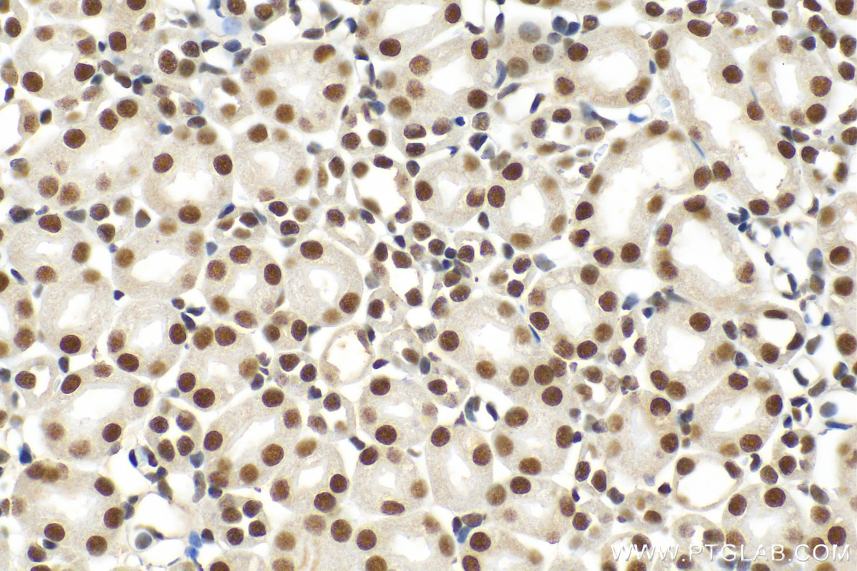 Immunohistochemistry (IHC) staining of mouse kidney tissue using HNRNPU Polyclonal antibody (16365-1-AP)