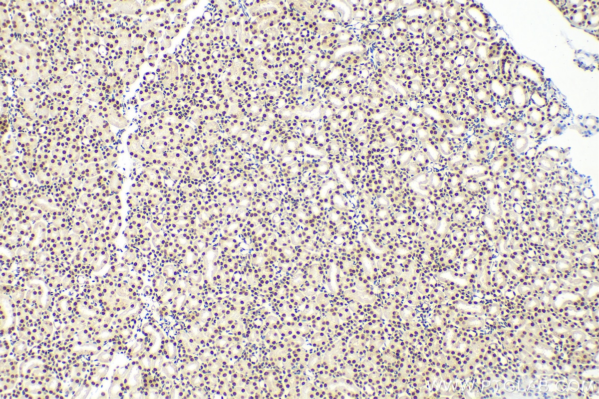 Immunohistochemistry (IHC) staining of mouse kidney tissue using HNRNPU Polyclonal antibody (16365-1-AP)