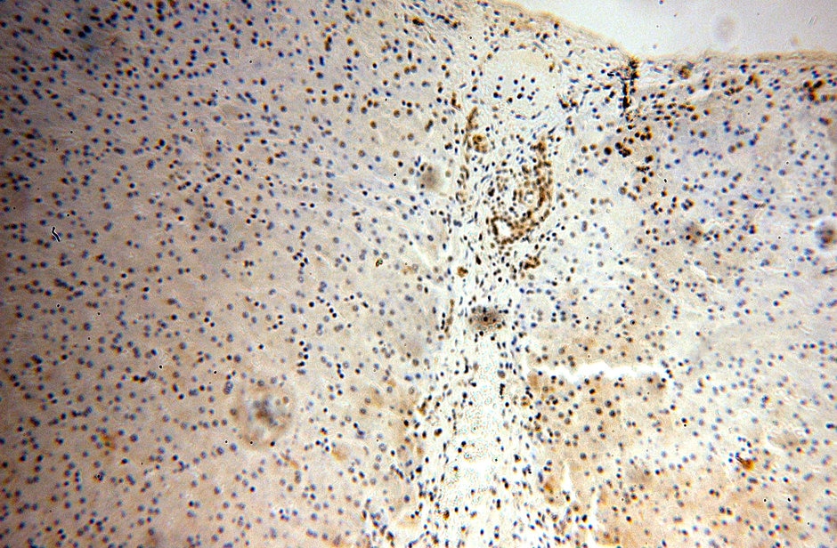 Immunohistochemistry (IHC) staining of human liver tissue using HNRNPU Polyclonal antibody (16365-1-AP)