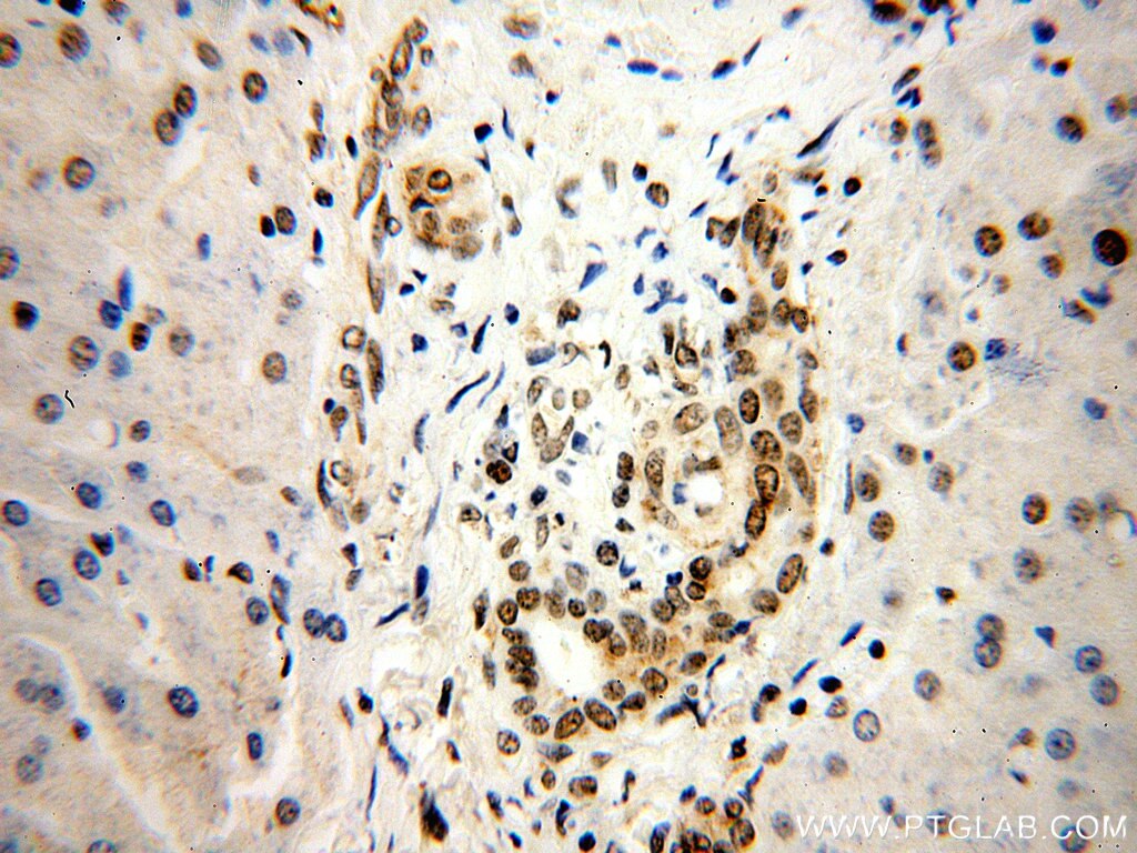 IHC staining of human liver using 16365-1-AP