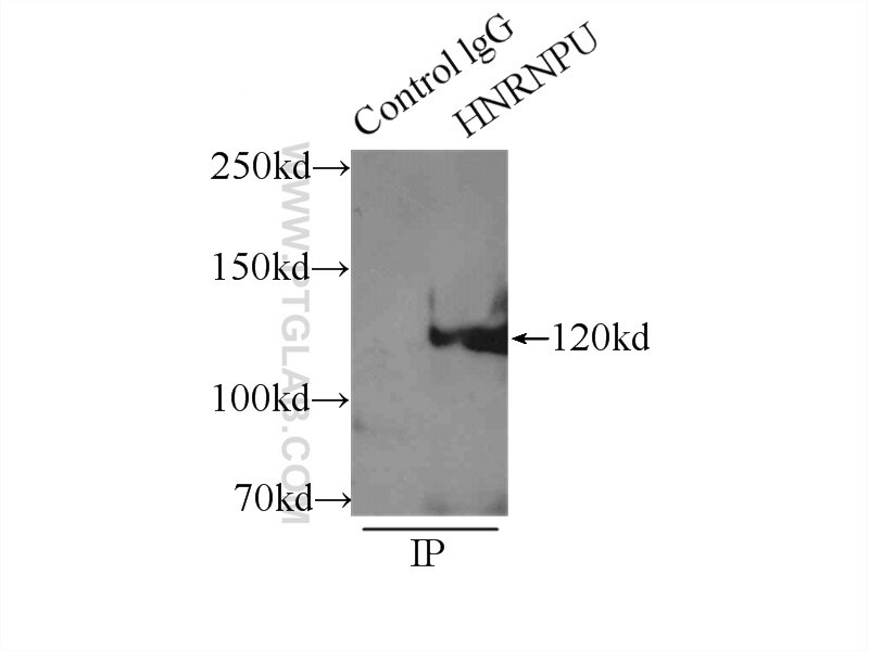 Immunoprecipitation (IP) experiment of HeLa cells using HNRNPU Polyclonal antibody (16365-1-AP)