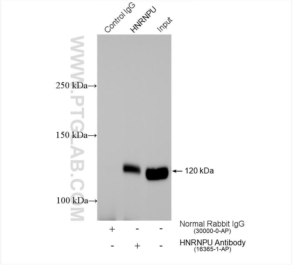 IP experiment of HeLa using 16365-1-AP