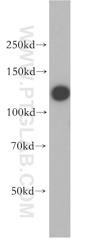 Western Blot (WB) analysis of HeLa cells using HNRNPU Polyclonal antibody (16365-1-AP)