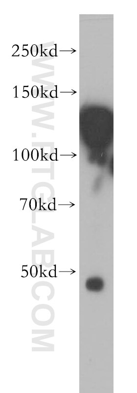 Western Blot (WB) analysis of Jurkat cells using HNRNPU Polyclonal antibody (16365-1-AP)