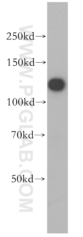 Western Blot (WB) analysis of HEK-293 cells using HNRNPU Polyclonal antibody (16365-1-AP)